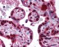DNMT / DNMT1 Antibody (aa177-550)